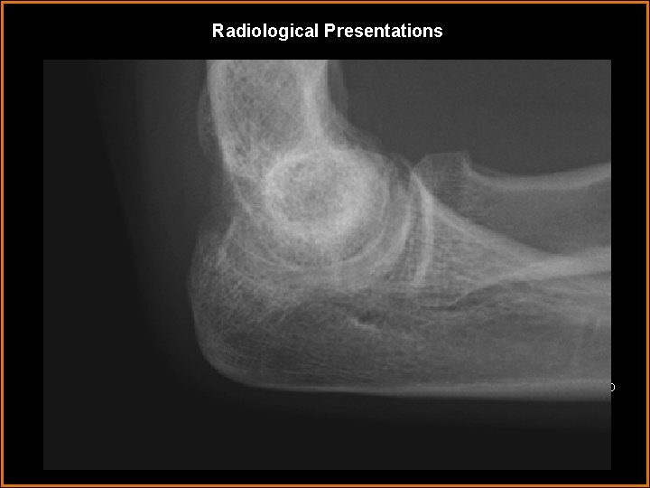 Radiological Presentations At 5 -month follow-up 