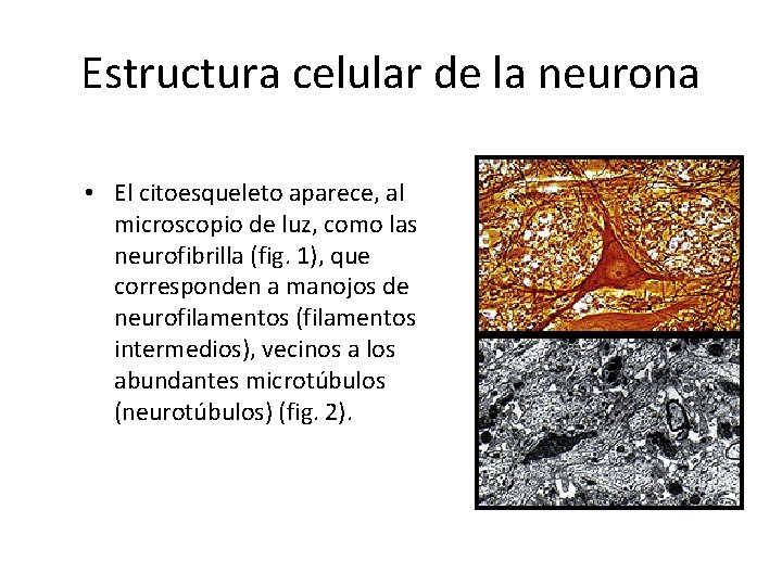 Estructura celular de la neurona • El citoesqueleto aparece, al microscopio de luz, como
