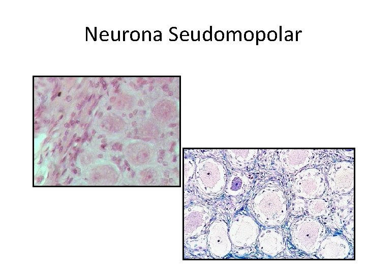 Neurona Seudomopolar 