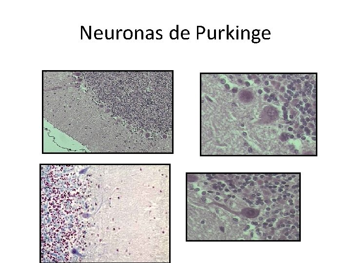Neuronas de Purkinge 