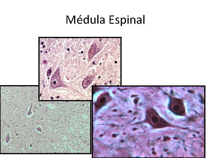 Médula Espinal 