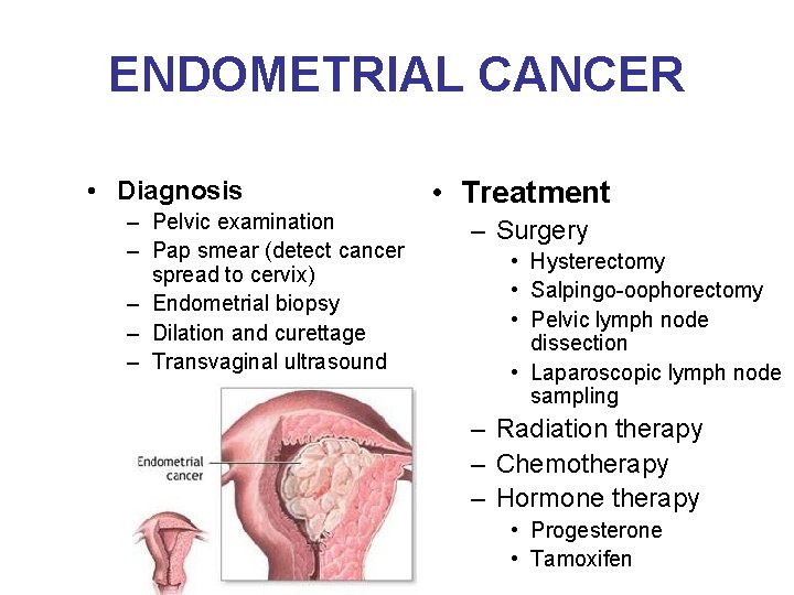 ENDOMETRIAL CANCER • Diagnosis – Pelvic examination – Pap smear (detect cancer spread to