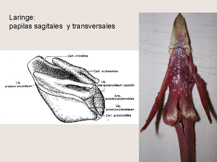 Laringe: papilas sagitales y transversales 