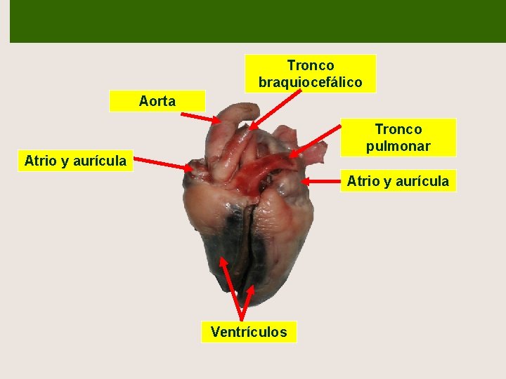 Tronco braquiocefálico Aorta Tronco pulmonar Atrio y aurícula Ventrículos 