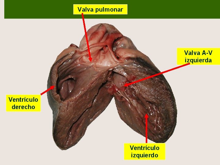 Valva pulmonar Valva A-V izquierda Ventrículo derecho Ventrículo izquierdo 