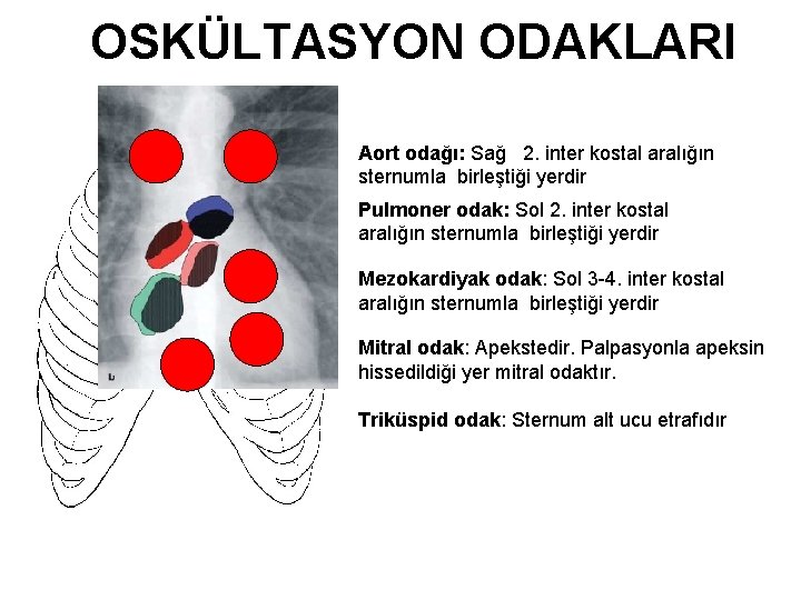 OSKÜLTASYON ODAKLARI Aort odağı: Sağ 2. inter kostal aralığın sternumla birleştiği yerdir Pulmoner odak: