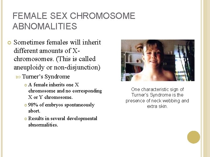 FEMALE SEX CHROMOSOME ABNOMALITIES Sometimes females will inherit different amounts of Xchromosomes. (This is