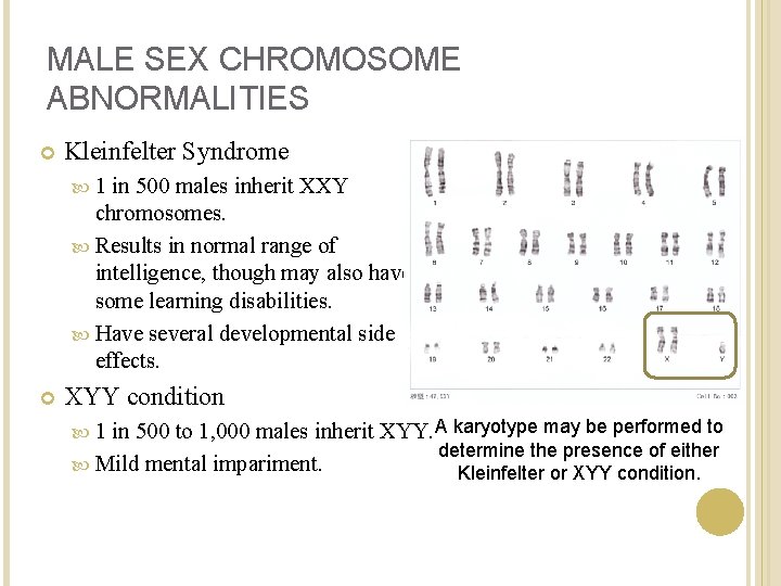 MALE SEX CHROMOSOME ABNORMALITIES Kleinfelter Syndrome 1 in 500 males inherit XXY chromosomes. Results