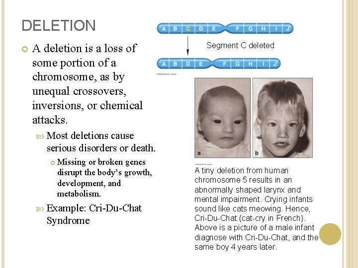 DELETION A deletion is a loss of some portion of a chromosome, as by