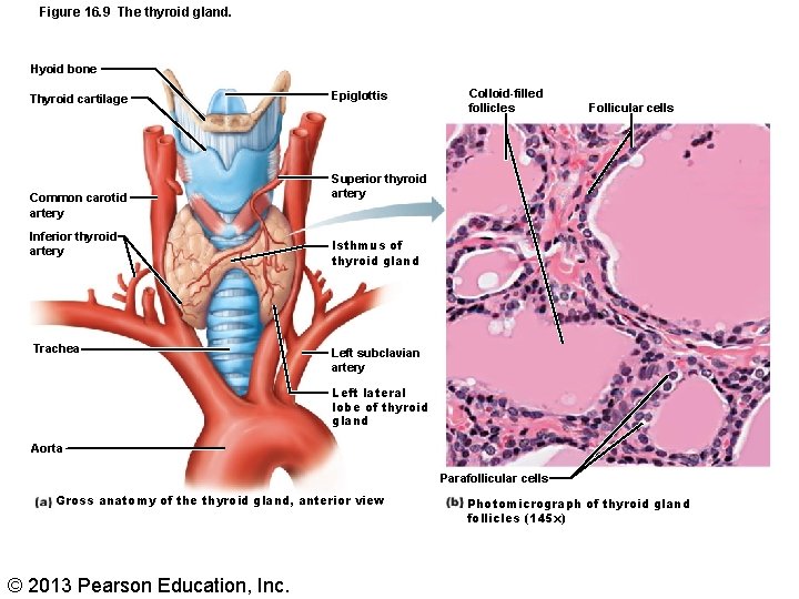 Figure 16. 9 The thyroid gland. Hyoid bone Thyroid cartilage Common carotid artery Inferior