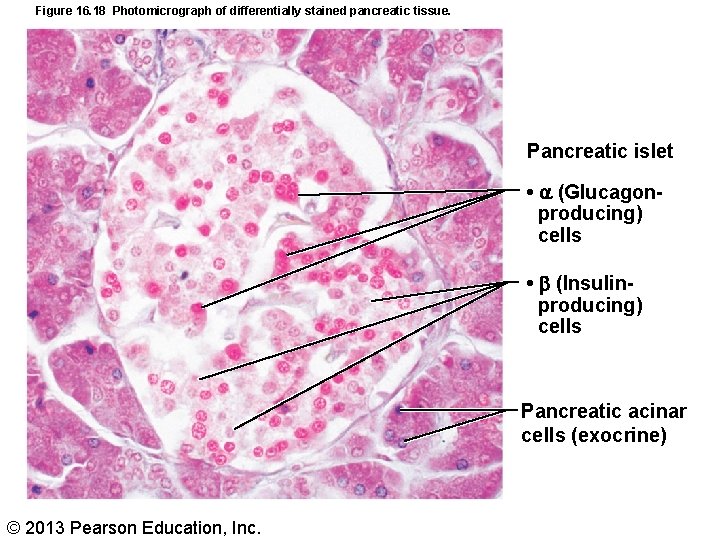 Figure 16. 18 Photomicrograph of differentially stained pancreatic tissue. Pancreatic islet • (Glucagonproducing) cells