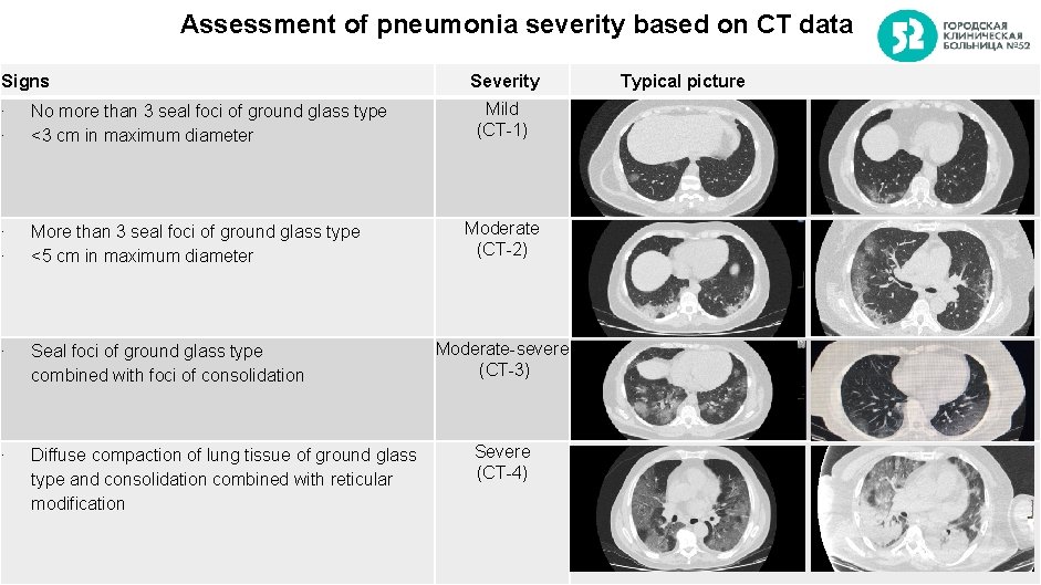 Assessment of pneumonia severity based on CT data Signs ∙ ∙ No more than
