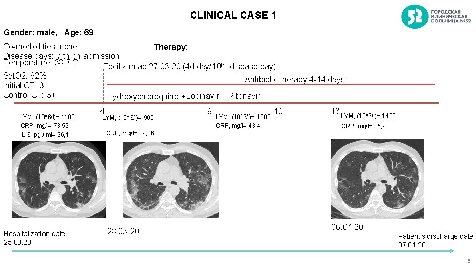 CLINICAL CASE 1 Gender: male, Age: 69 Co-morbidities: none Therapy: Disease days: 7 -th