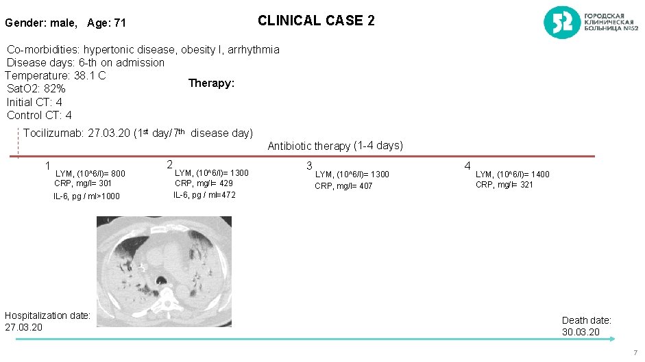 CLINICAL CASE 2 Gender: male, Age: 71 Co-morbidities: hypertonic disease, obesity I, arrhythmia Disease