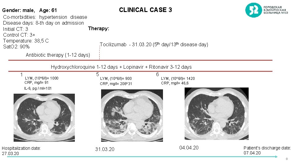 CLINICAL CASE 3 Gender: male, Age: 61 Co-morbidities: hypertension disease Disease days: 8 -th