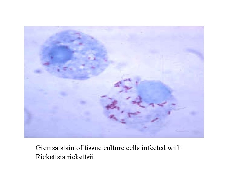 Giemsa stain of tissue culture cells infected with Rickettsia rickettsii 