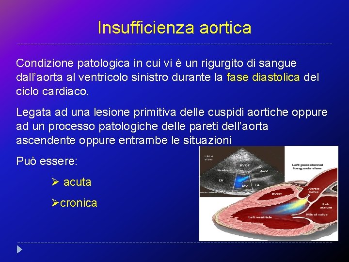 Insufficienza aortica Condizione patologica in cui vi è un rigurgito di sangue dall’aorta al