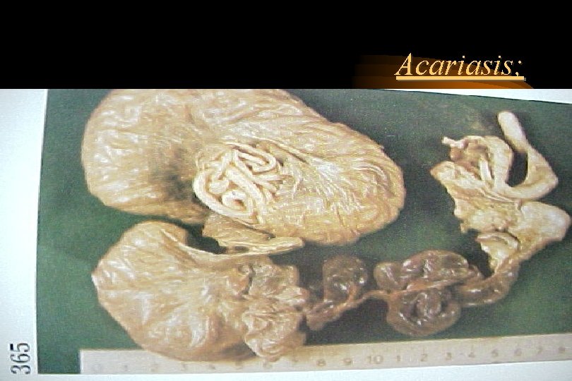 Acariasis; Acariasis;