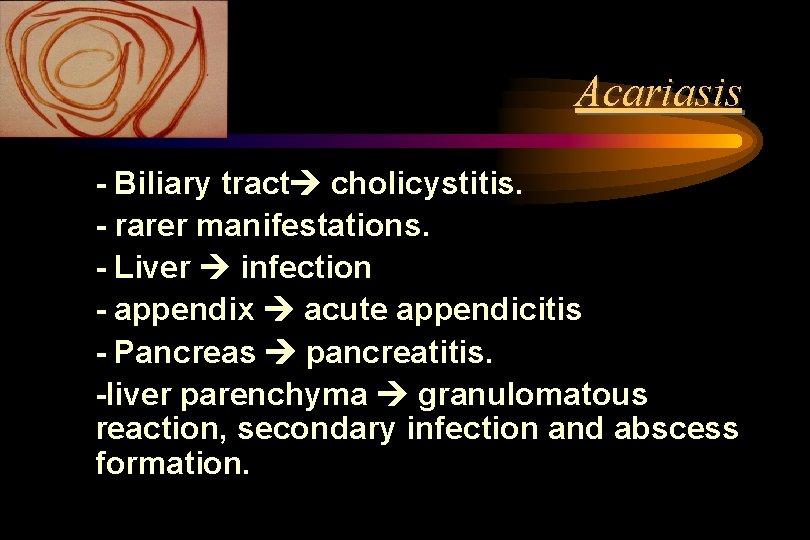Acariasis - Biliary tract cholicystitis. - rarer manifestations. - Liver infection - appendix acute Acariasis - Biliary tract cholicystitis. - rarer manifestations. - Liver infection - appendix acute