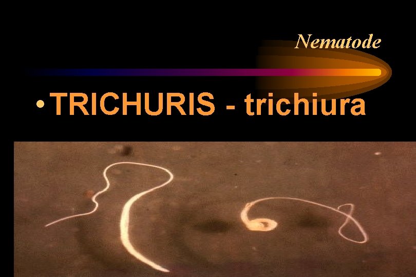 Nematode • TRICHURIS - trichiura Nematode • TRICHURIS - trichiura