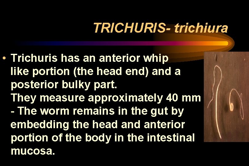 TRICHURIS- trichiura • Trichuris has an anterior whip like portion (the head end) and TRICHURIS- trichiura • Trichuris has an anterior whip like portion (the head end) and