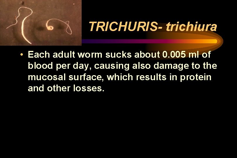 TRICHURIS- trichiura • Each adult worm sucks about 0. 005 m. I of blood TRICHURIS- trichiura • Each adult worm sucks about 0. 005 m. I of blood