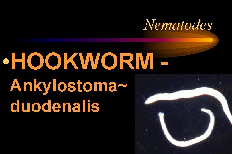 Nematodes • HOOKWORM Ankylostoma~ duodenalis Nematodes • HOOKWORM Ankylostoma~ duodenalis