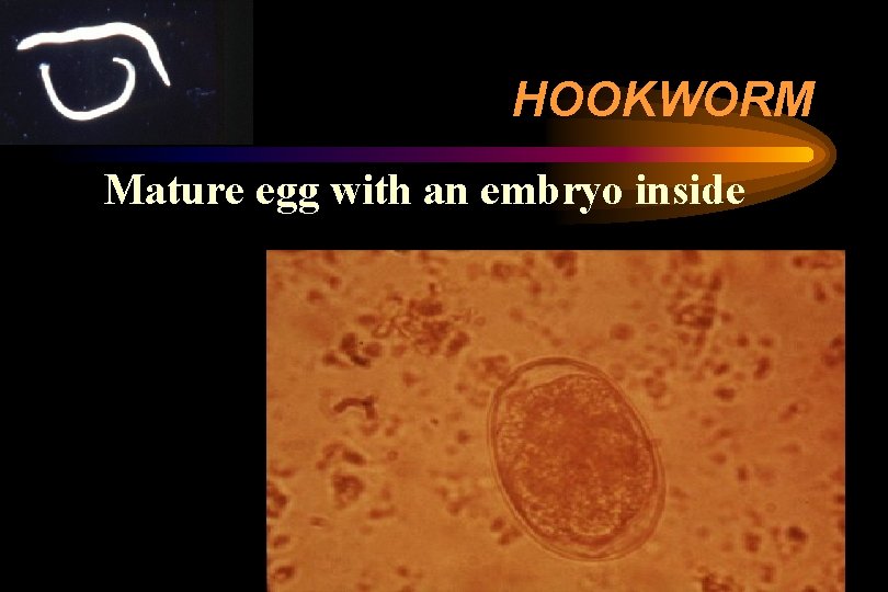 HOOKWORM Mature egg with an embryo inside HOOKWORM Mature egg with an embryo inside