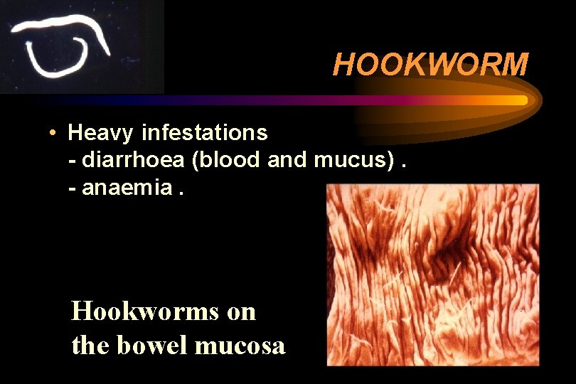HOOKWORM • Heavy infestations - diarrhoea (blood and mucus). - anaemia. Hookworms on the HOOKWORM • Heavy infestations - diarrhoea (blood and mucus). - anaemia. Hookworms on the