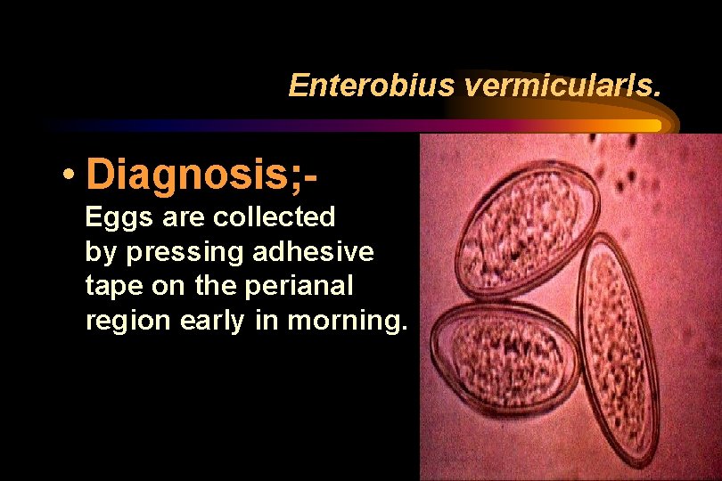 Enterobius vermicularls. • Diagnosis; Eggs are collected by pressing adhesive tape on the perianal Enterobius vermicularls. • Diagnosis; Eggs are collected by pressing adhesive tape on the perianal