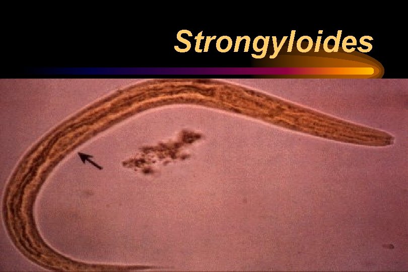 Strongyloides Strongyloides