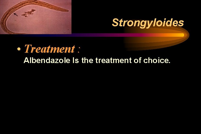 Strongyloides • Treatment : Albendazole Is the treatment of choice. Strongyloides • Treatment : Albendazole Is the treatment of choice.