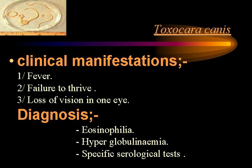 Toxocara canis • clinical manifestations; 1/ Fever. 2/ Failure to thrive. 3/ Loss of Toxocara canis • clinical manifestations; 1/ Fever. 2/ Failure to thrive. 3/ Loss of