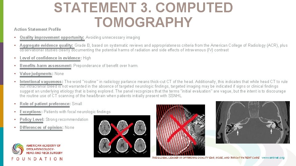 STATEMENT 3. COMPUTED TOMOGRAPHY Action Statement Profile • Quality improvement opportunity: Avoiding unnecessary imaging STATEMENT 3. COMPUTED TOMOGRAPHY Action Statement Profile • Quality improvement opportunity: Avoiding unnecessary imaging