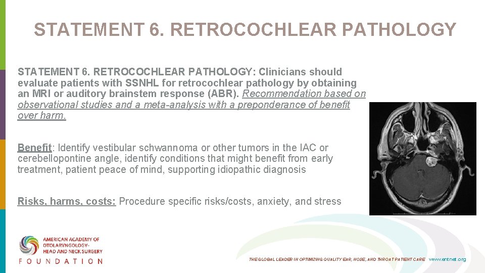 STATEMENT 6. RETROCOCHLEAR PATHOLOGY: Clinicians should evaluate patients with SSNHL for retrocochlear pathology by STATEMENT 6. RETROCOCHLEAR PATHOLOGY: Clinicians should evaluate patients with SSNHL for retrocochlear pathology by