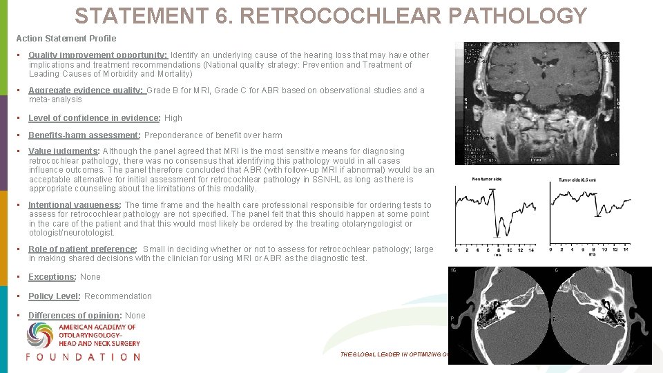 STATEMENT 6. RETROCOCHLEAR PATHOLOGY Action Statement Profile • Quality improvement opportunity: Identify an underlying STATEMENT 6. RETROCOCHLEAR PATHOLOGY Action Statement Profile • Quality improvement opportunity: Identify an underlying