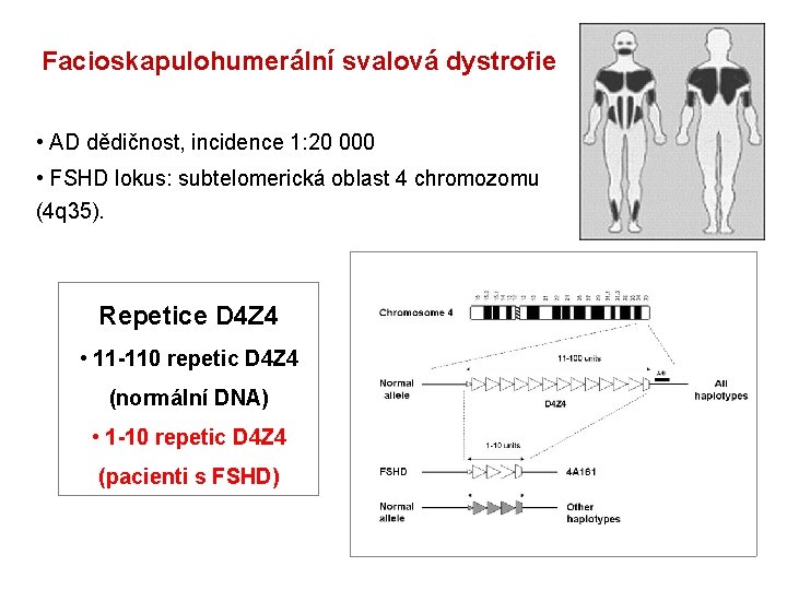 Facioskapulohumerální svalová dystrofie • AD dědičnost, incidence 1: 20 000 • FSHD lokus: subtelomerická