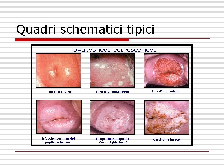 Quadri schematici tipici 