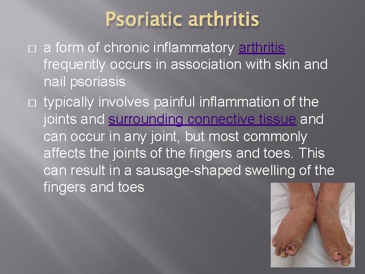 Psoriatic arthritis � � a form of chronic inflammatory arthritis frequently occurs in association