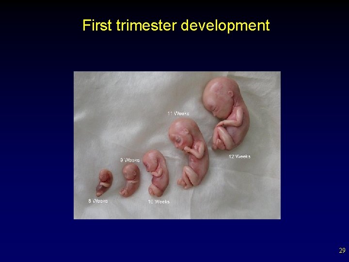 First trimester development 29 