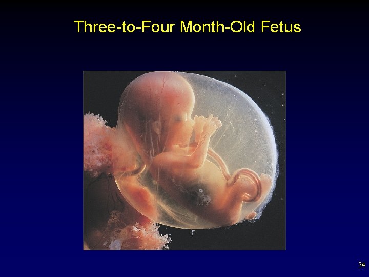 Three-to-Four Month-Old Fetus 34 