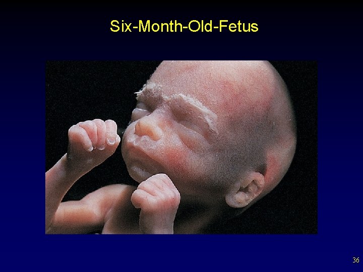 Six-Month-Old-Fetus 36 