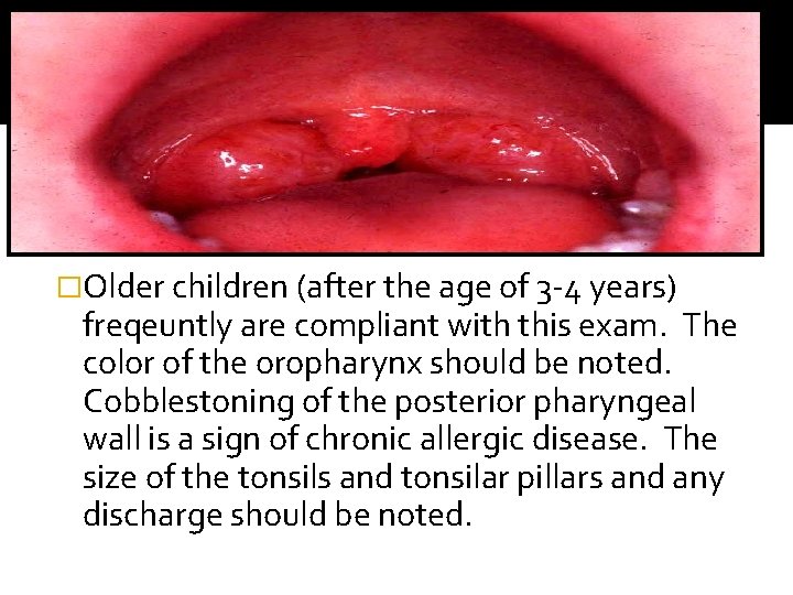 EXAMINATION OF THE RESPIRATORY SYSTEM �Older children (after the age of 3 -4 years)
