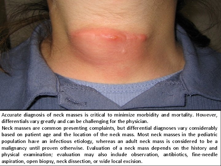 Accurate diagnosis of neck masses is critical to minimize morbidity and mortality. However, differentials