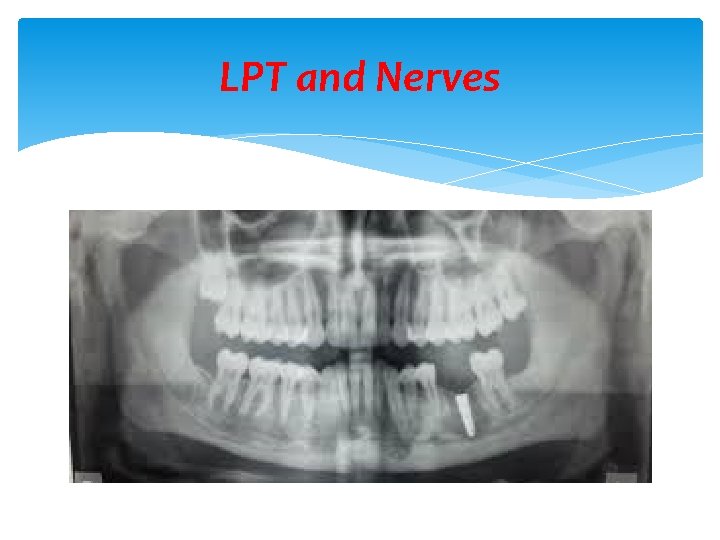 LPT and Nerves 