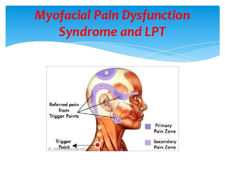 Myofacial Pain Dysfunction Syndrome and LPT 