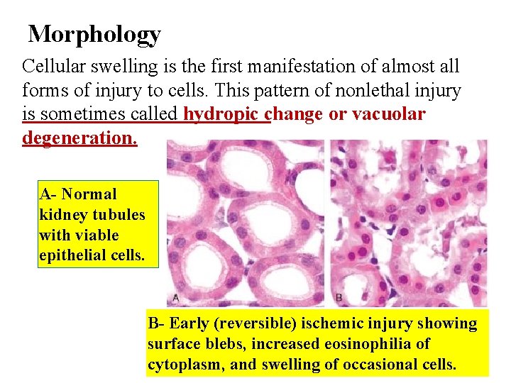 Morphology Cellular swelling is the first manifestation of almost all forms of injury to