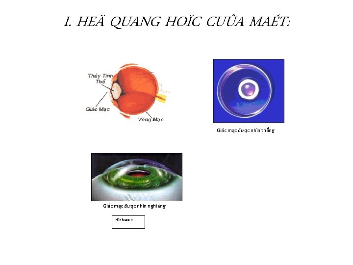 I. HEÄ QUANG HOÏC CUÛA MAÉT: Giác mạc được nhìn thẳng Giác mạc được