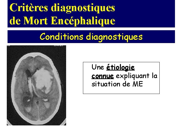 Critères diagnostiques de Mort Encéphalique Conditions diagnostiques Une étiologie connue expliquant la situation de