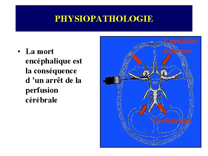 PHYSIOPATHOLOGIE • La mort encéphalique est la conséquence d ’un arrêt de la perfusion